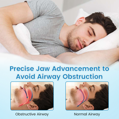 🔥✨PerfectSleep Solution- Anti-Snoring & Anti-Grinding Teeth Protector
